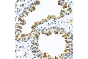 Immunohistochemistry of paraffin-embedded mouse lung using SERPINA10 antibody. (SERPINA10 anticorps  (AA 165-444))