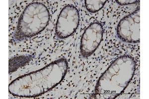 Immunoperoxidase of monoclonal antibody to HMG20A on formalin-fixed paraffin-embedded human colon.