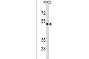 ZN Antibody (Center) (ABIN1537894 and ABIN2843344) western blot analysis in K562 cell line lysates (35 μg/lane). (ZNF733 anticorps  (AA 156-183))