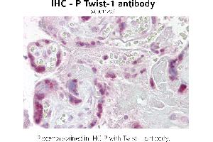 Image no. 2 for anti-Twist Homolog 1 (Drosophila) (TWIST1) (N-Term) antibody (ABIN347415) (TWIST1 anticorps  (N-Term))