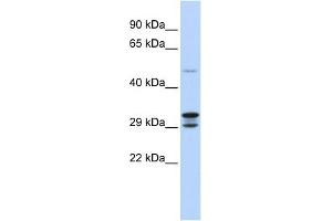 WB Suggested Anti-C14orf166 Antibody Titration:  0.