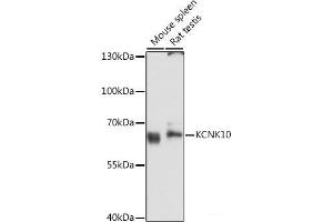 Western blot analysis of extracts of various cell lines using KCNK10 Polyclonal Antibody at dilution of 1:3000. (KCNK10 anticorps)