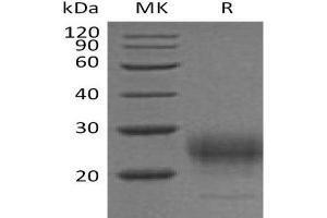Western Blotting (WB) image for Interleukin 7 (IL7) (Active) protein (His tag) (ABIN7320603)