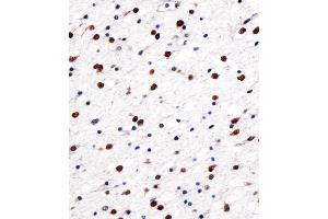 anti-Neuro-Oncological Ventral Antigen 1 (NOVA1) (AA 139-173) antibody