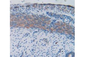 IHC-P analysis of uterus tissue, with DAB staining. (FIL1d anticorps  (AA 1-156))