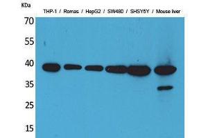 Western Blotting (WB) image for anti-Interleukin 10 (IL10) (Internal Region) antibody (ABIN3187685)