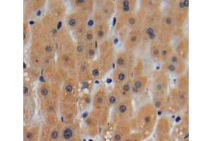 Used in DAB staining on fromalin fixed paraffin-embedded liver tissue (ROCK1 anticorps  (AA 1094-1323))