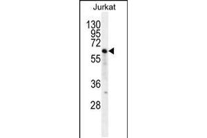 Western blot analysis in Jurkat cell line lysates (35ug/lane). (NKD2 anticorps  (C-Term))