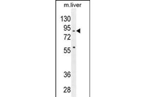 SPIRE2 Antibody (Center) (ABIN654557 and ABIN2844264) western blot analysis in mouse liver tissue lysates (35 μg/lane). (SPIRE2 anticorps  (AA 285-313))