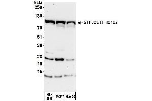 Western Blotting (WB) image for anti-General Transcription Factor 3C Polypeptide 3 (GTF3C3) (AA 475-525) antibody (ABIN7454731) (General Transcription Factor 3C Polypeptide 3 (GTF3C3) (AA 475-525) anticorps)