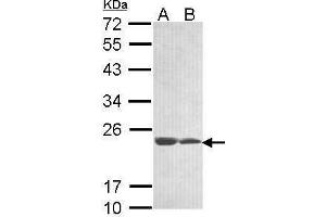WB Image Sample (30 ug of whole cell lysate) A: 293T B: A431 , 12% SDS PAGE antibody diluted at 1:1000 (C11orf85 anticorps  (Center))