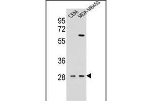 IL12B Antibody (C-term) (ABIN654420 and ABIN2844155) western blot analysis in CEM,MDA-M cell line lysates (35 μg/lane). (IL12B anticorps  (C-Term))