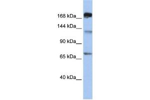 WB Suggested Anti-MTR Antibody Titration:  0. (MTR anticorps  (C-Term))