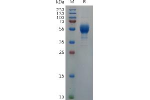 Cynomolgus IL9 Protein, hFc Tag on SDS-PAGE under reducing condition.