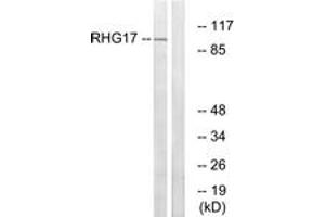 Western Blotting (WB) image for anti-rho GTPase Activating Protein 17 (ARHGAP17) (AA 331-380) antibody (ABIN2890584) (ARHGAP17 anticorps  (AA 331-380))