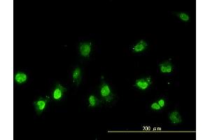 Immunofluorescence of monoclonal antibody to NEK11 on HeLa cell.