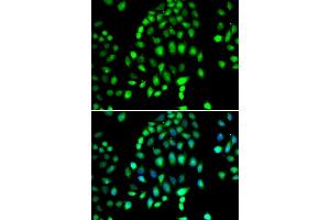Immunofluorescence analysis of MCF-7 cells using P antibody (ABIN6132460, ABIN6145238, ABIN6145239 and ABIN6223130). (PARP3 anticorps  (AA 301-540))