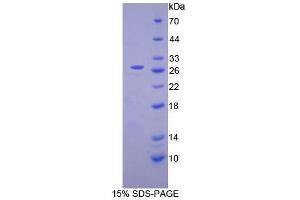 SDS-PAGE analysis of Mouse Complement Receptor 2 Protein. (CD21 Protéine)