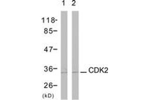 Western blot analysis of extracts from A2780 cells, using CDK2 (Ab-160) Antibody. (CDK2 anticorps  (AA 131-180))
