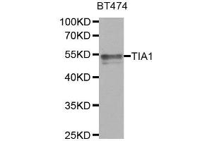 Western Blotting (WB) image for anti-TIA1 Cytotoxic Granule-Associated RNA Binding Protein (TIA1) antibody (ABIN1882364) (TIA1 anticorps)