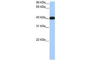 WB Suggested Anti-NOL5A Antibody Titration:  0. (NOP56 anticorps  (Middle Region))