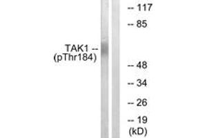 Western blot analysis of extracts from HepG2 cells treated with TNF 20ng/ml 5', using TAK1 (Phospho-Thr184) Antibody.