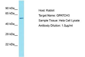 Host: Rabbit Target Name: GPATCH3 Sample Tissue: Human Hela Whole cell Antibody Dilution: 1ug/ml (GPATCH3 anticorps  (C-Term))
