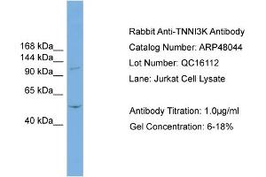 WB Suggested Anti-TNNI3K  Antibody Titration: 0. (TNNI3K anticorps  (N-Term))