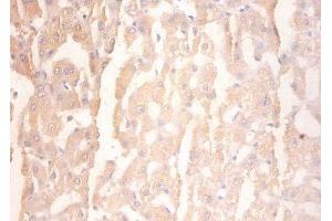 Immunohistochemistry of paraffin-embedded human liver tissue using ABIN7154210 at dilution of 1:100