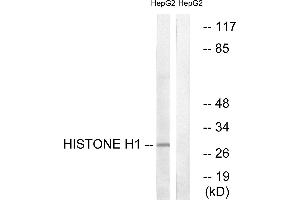 Immunohistochemistry analysis of paraffin-embedded human colon carcinoma tissue using Histone H1 (Ab-17) antibody. (Histone H1 anticorps)
