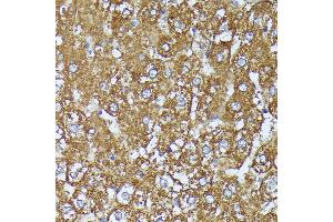 Immunohistochemistry of paraffin-embedded rat liver using C2 Rabbit pAb (ABIN7265549) at dilution of 1:100 (40x lens). (AKR1C2 anticorps  (AA 1-323))