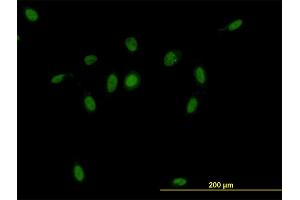 Immunofluorescence of monoclonal antibody to CSE1L on HeLa cell. (Exportin 2 anticorps  (AA 872-971))