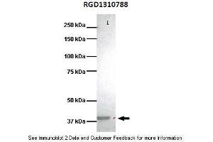 Lanes:  Lane1: 25ug human bronchoepithelisal lysate Primary Antibody Dilution:  1:1000 Secondary Antibody:  Goat anti-rabbit HRP Secondary Antibody Dilution:  1:1000 Gene Name:  RGD1310788 Submitted by:  Murline Gelin, University of Miami School of Medicine