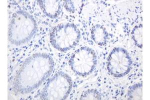 Image no. 6 for anti-Proliferating Cell Nuclear Antigen (PCNA) antibody (ABIN1500061) (PCNA anticorps)