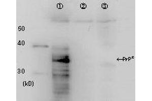 Western Blotting (WB) image for anti-Prion Protein (PRNP) antibody (ABIN2452081) (PRNP anticorps)