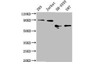 Western Blot Positive WB detected in: 293 whole cell lysate, Jurkat whole cell lysate, SH-SY5Y whole cell lysate, U87 whole cell lysate All lanes: FOXO3A antibody at 1.