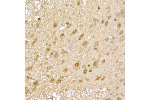 Immunohistochemistry of paraffin-embedded mouse spinal cord using PSM Rabbit pAb (752) at dilution of 1:50 (40x lens). (PSMA5 anticorps  (AA 1-241))