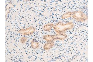 ABIN6267269 at 1/100 staining rat uterine tissue sections by IHC-P. (EGFR anticorps  (pSer1071))