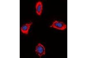 Immunofluorescent analysis of Alpha-1D Adrenergic Receptor staining in MCF7 cells.