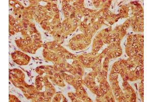 anti-MOB Kinase Activator 1B (MOB1B) (AA 2-216) antibody