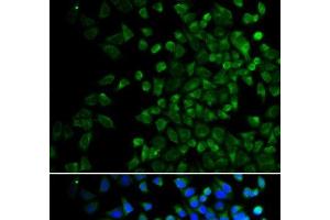 Immunofluorescence analysis of HeLa cells using BAK1 Polyclonal Antibody (BAK1 anticorps)