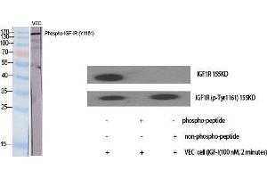 Western Blot (WB) analysis of specific cells using Phospho-IGF-IR (Y1161) Polyclonal Antibody.