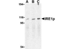 Image no. 1 for anti-Endoplasmic Reticulum To Nucleus Signaling 1 (ERN1) (C-Term) antibody (ABIN318702) (ERN1 anticorps  (C-Term))