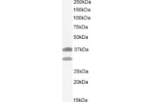 (ABIN184675) (1 μg/mL) staining of RatLiver lysate (35 μg protein in RIPA buffer).