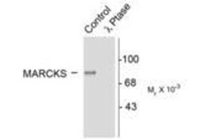 Image no. 1 for anti-Myristoylated Alanine-Rich Protein Kinase C Substrate (MARCKS) (pSer152), (Ser156) antibody (ABIN227290)