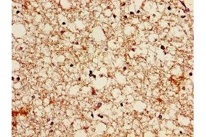 Immunohistochemistry of paraffin-embedded human brain tissue using ABIN7145700 at dilution of 1:100