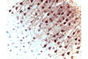 Immunohistochemical staining of ERK1 in pyrimidal cells from the rat cortex: formalin-fixed paraffin-embedded tissue, with citrate pre-treatment (40X magnification).