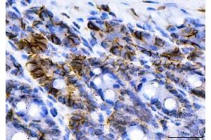 IHC analysis of NKCC1/SLC12A2 using anti-NKCC1/SLC12A2 antibody (ABIN7602601).