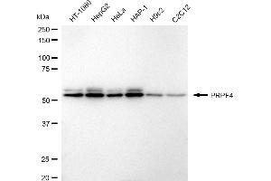 Western blotting analysis using PRPF4 antibody (ABIN7800056).