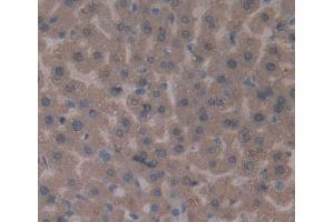 Used in DAB staining on fromalin fixed paraffin- embedded liver tissue (LDLR anticorps)